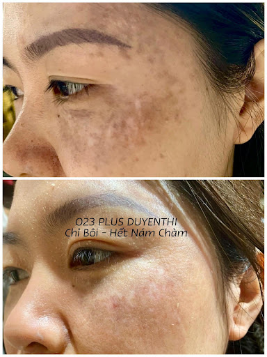 Thu Phương Facial Spa - Spa Trị Mụn tại Thạch Thất, Hà Nội