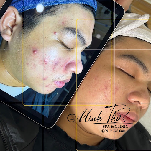 Minh Thư Beauty Spa - Spa Trị Mụn tại Diên Khánh, Khánh Hòa