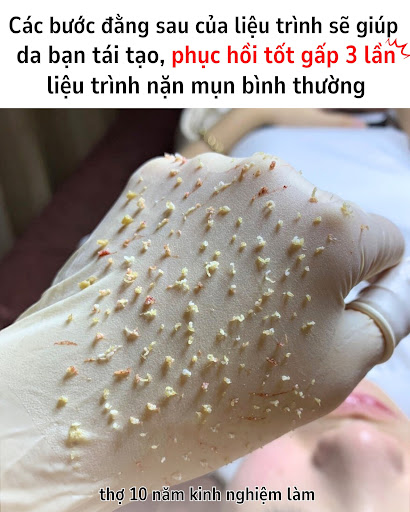 Đông Nghi Spa - Địa Chỉ Phun Xăm tại Buôn Ma Thuột, Đắk Lắk