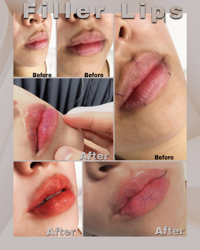 Băng Băng Spa Kiên Lương - Spa Massage tại Kiên Lương, Kiên Giang