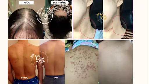 Gừng Spa Quận 4- Gội Đầu Dưỡng Sinh Quận 4, Massage Body, Làm Nail Sơn Gel, Massage Cổ Vai Gáy - Spa Massage tại Quận 4, TP HCM