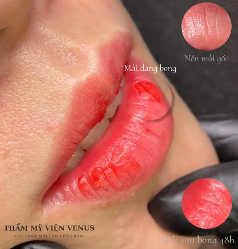 THẨM MỸ VIỆN QUỐC TẾ AZ VENUS - Địa Chỉ Phun Xăm tại Vĩnh Thuận, Kiên Giang