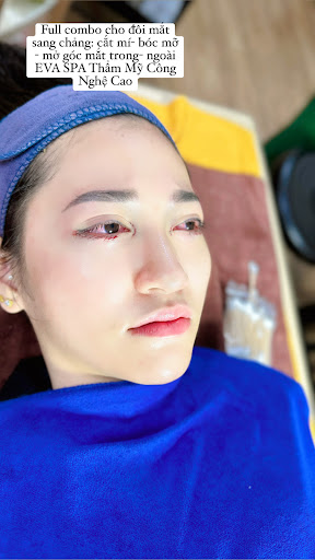 Eva Spa - Spa Trị Mụn tại Thanh Trì, Hà Nội