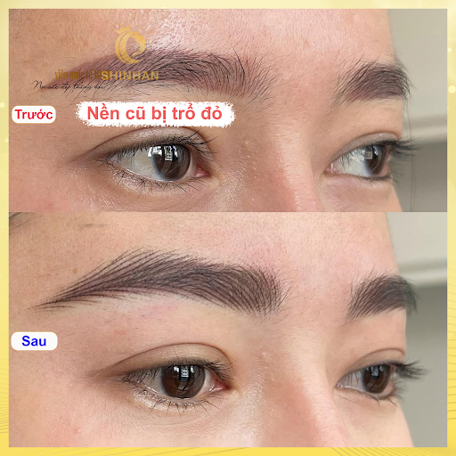 Viện Thẩm Mỹ Shinhan - Bình Phước - Địa Chỉ Phun Xăm tại Đồng Xoài, Bình Phước