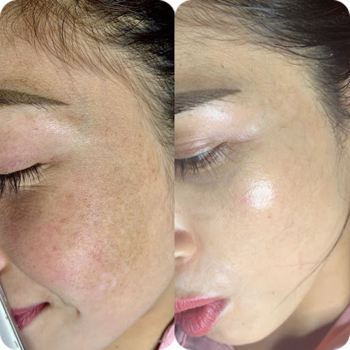 Valita Spa Long Biên - Spa Trị Mụn tại Long Biên, Hà Nội