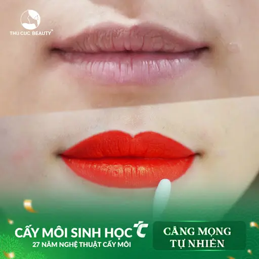 Thu Cúc Mega Beauty Center Cầu Giấy - Spa Trị Mụn tại Cầu Giấy, Hà Nội