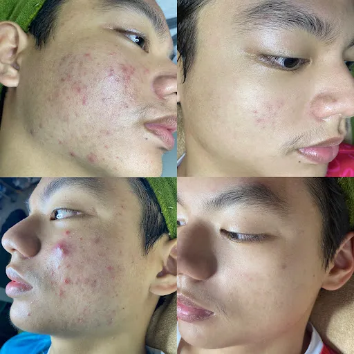 SPA THẮM ( chăm sóc da - phun xăm thẩm mỹ ) - Địa Chỉ Phun Xăm tại Chư Păh, Gia Lai