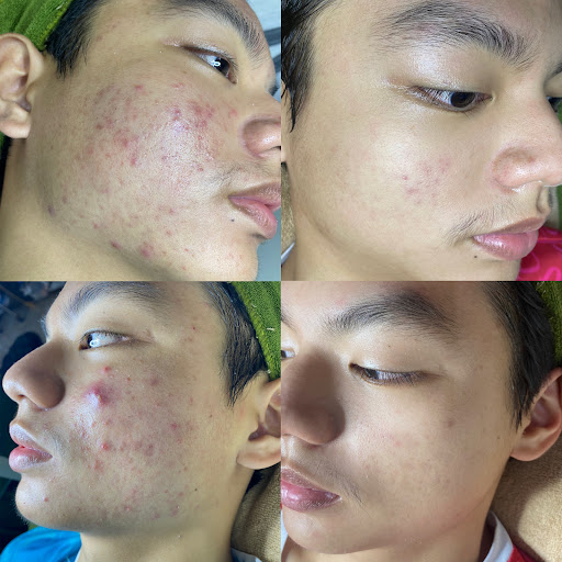 SPA THẮM ( chăm sóc da - phun xăm thẩm mỹ ) - Địa Chỉ Phun Xăm tại Chư Pưh, Gia Lai