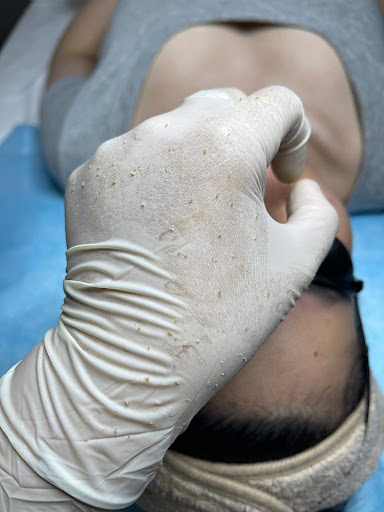 TRÂM SPA - Spa Trị Mụn tại Bình Chánh,TP HCM