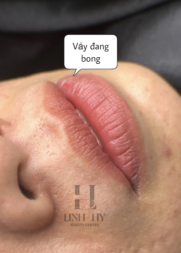 LINH HY PMU - Địa Chỉ Phun Xăm tại Biên Hòa, Đồng Nai