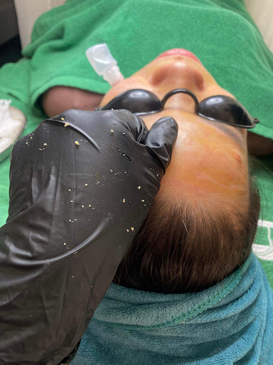 Herrin Spa Quỳnh Hiên - Spa Trị Mụn tại Chương Mỹ, Hà Nội