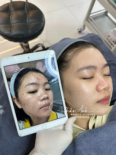 Thẩm Mỹ Viện / Spa Thảo Anh - Spa Triệt Lông tại Vĩnh Hưng, Long An