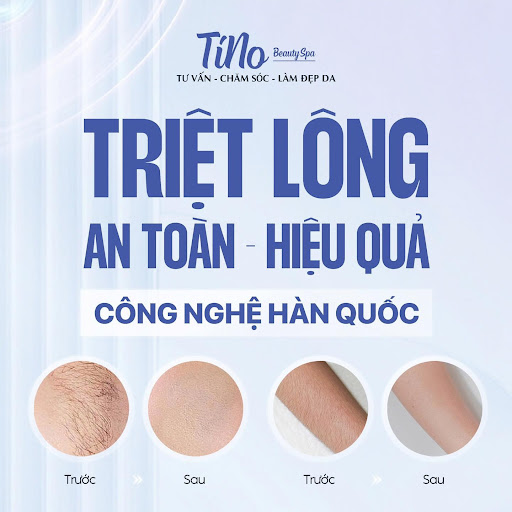 TiNo Beauty Spa - Spa Triệt Lông tại Đức Huệ, Long An