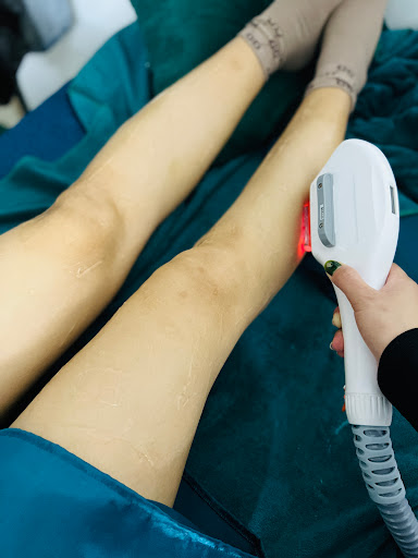 Spa Làm đẹp - Spa Triệt Lông tại Hồng Lĩnh, Hà Tĩnh