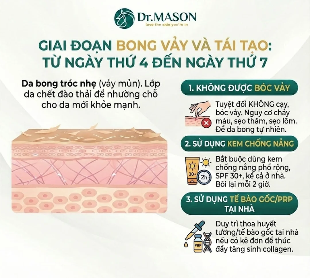 cách chăm sóc da sau khi cấy máu tự thân khi bong mài