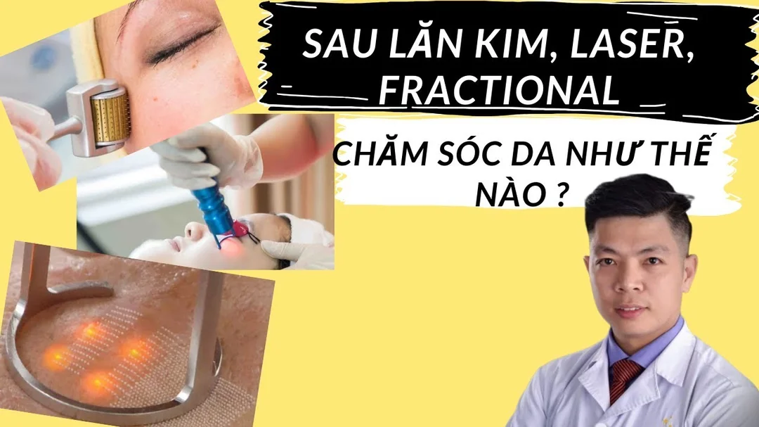 Cách chăm sóc da sau khi lăn kim, laser, fractional
