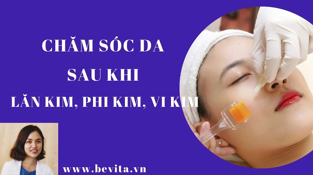 Cách chăm sóc da sau khi lăn kim, phi kim, vi kim tảo biển