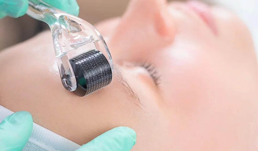 chăm sóc da sau lăn kim khi da phục hồi và cần theo dõi biến chứng