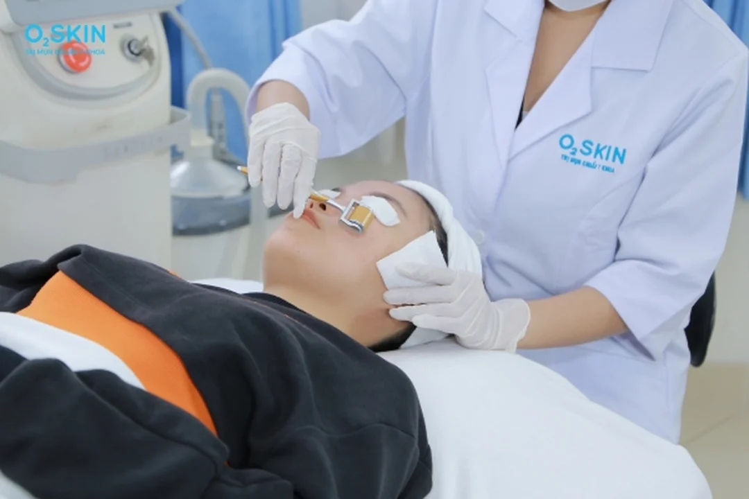 chăm sóc da sau lăn kim tại cơ sở chuẩn y khoa an toàn hơn tự làm