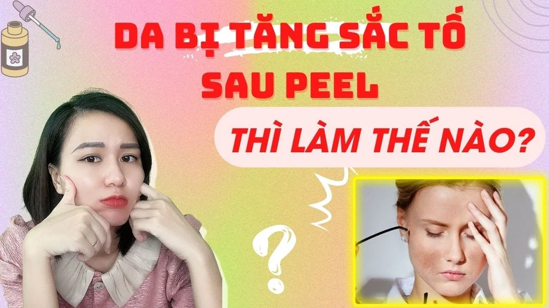 Chăm sóc da sau peel ? Peel da bị tăng sắc tố phải làm sao?