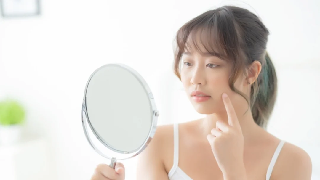 chăm sóc da tuổi dậy thì bằng sản phẩm dịu nhẹ cho da mụn