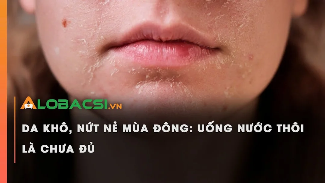 Da khô, nứt nẻ mùa đông: Uống nước thôi là chưa đủ