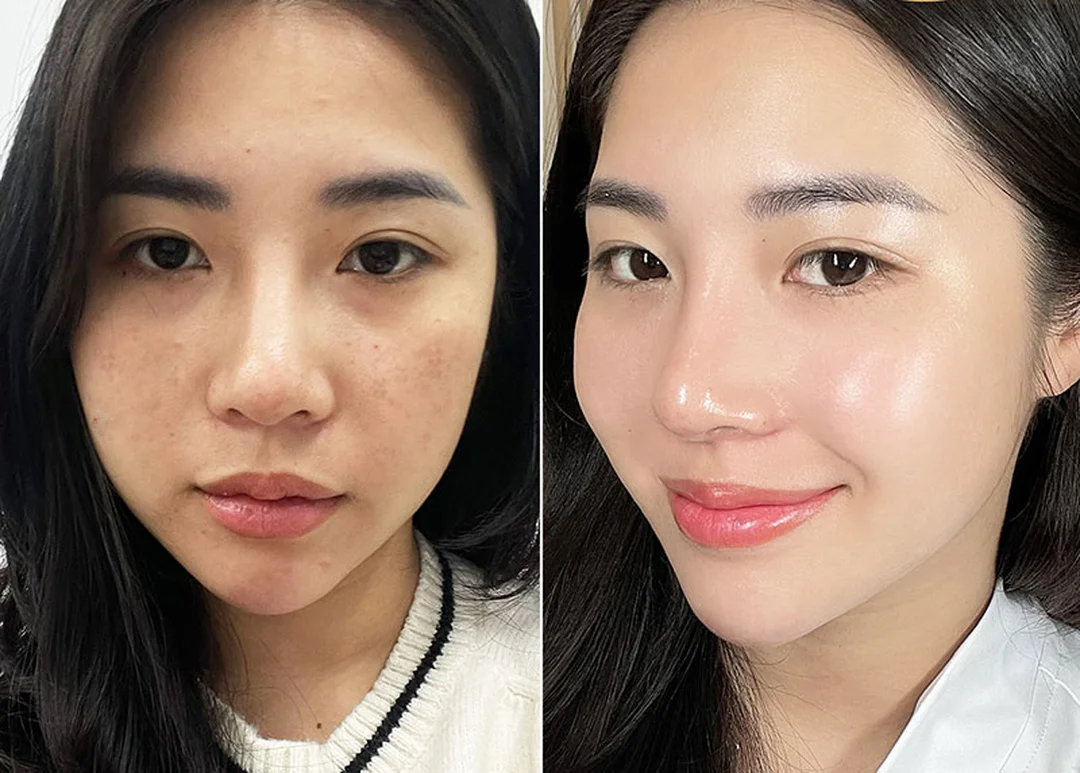 dịch vụ chăm sóc da gò vấp công nghệ cao