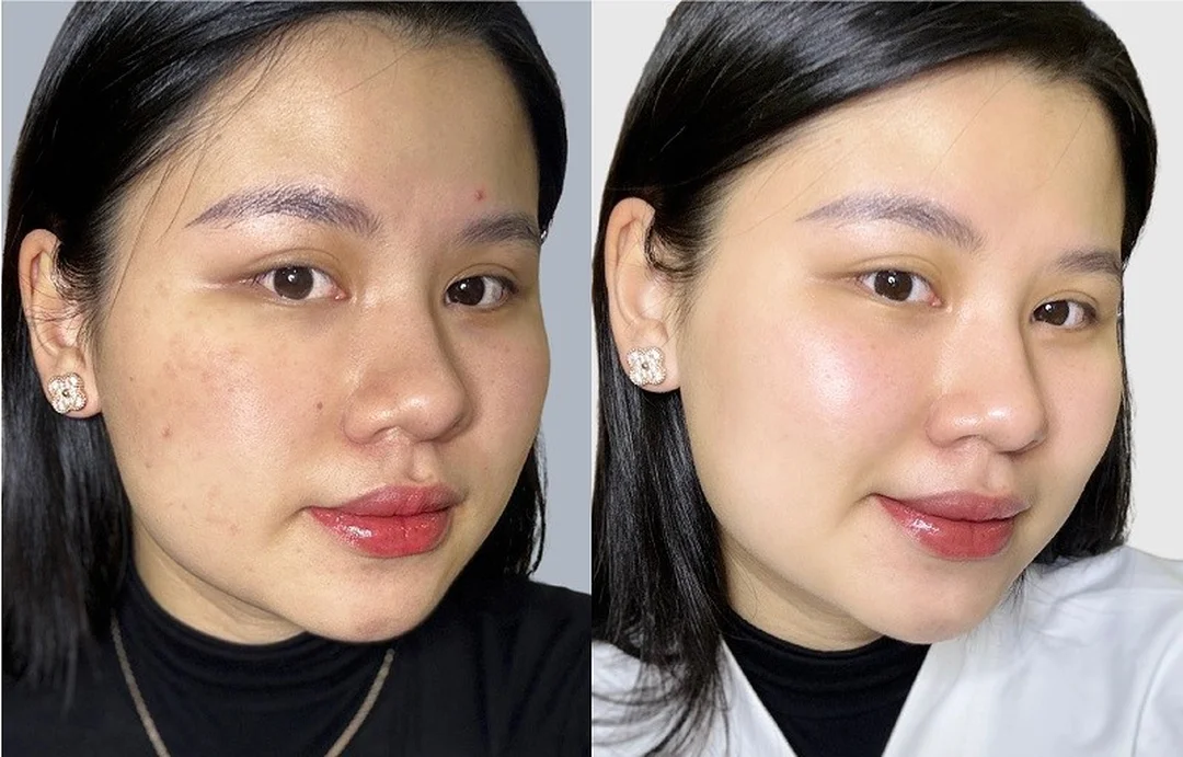 quy trình chăm sóc da gò vấp chuẩn spa