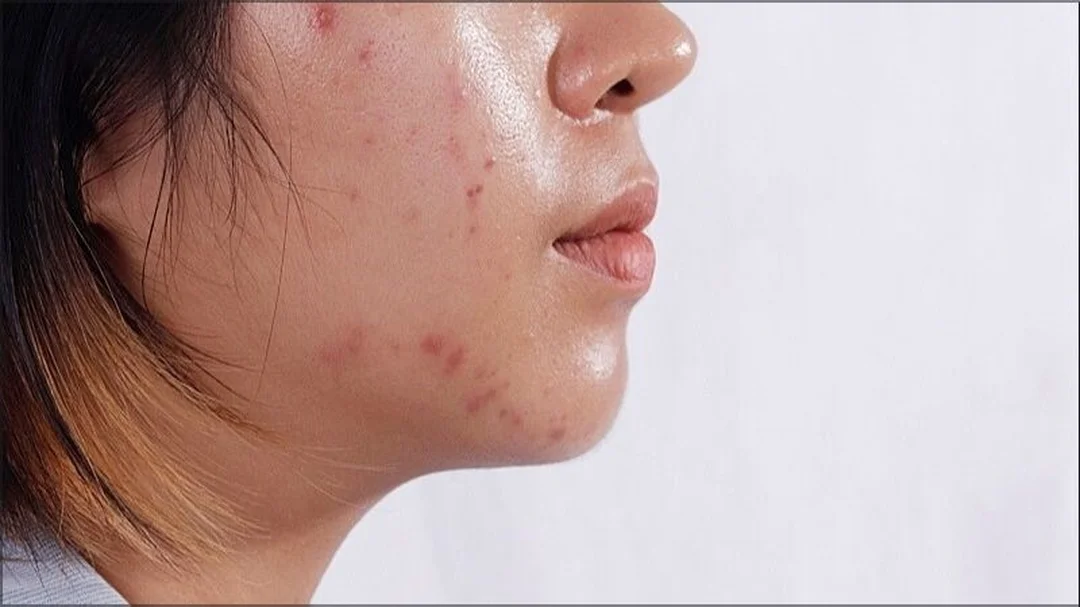 quy trình skincare ban ngày đúng chuẩn