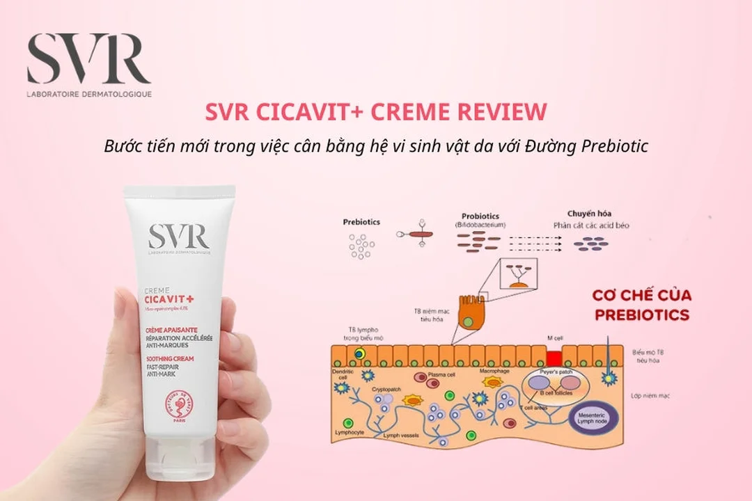 so sánh kem phục hồi da sau nặn mụn phổ biến